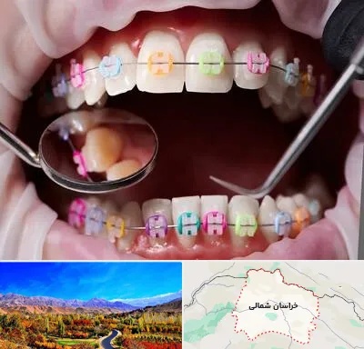 متخصص ارتودنسی در خراسان شمالی