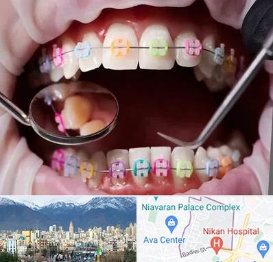 متخصص ارتودنسی در آجودانیه 