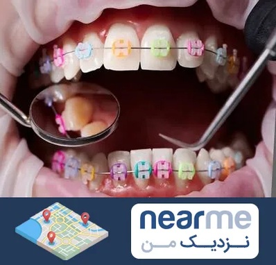 متخصص ارتودنسی در نزدیک من