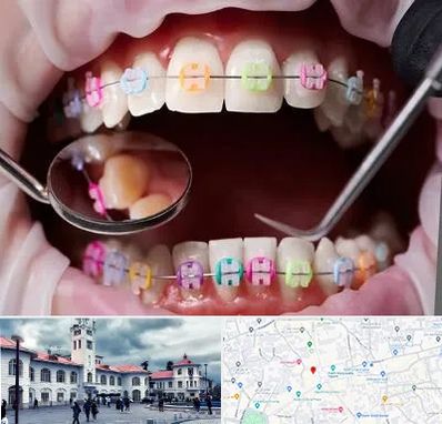 متخصص ارتودنسی در میدان شهرداری رشت