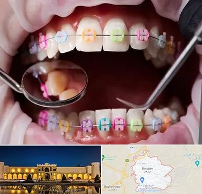 متخصص ارتودنسی در برازجان