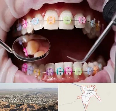 متخصص ارتودنسی در اسفراین