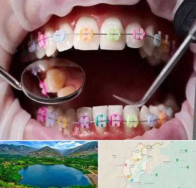 متخصص ارتودنسی در رودبار