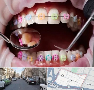متخصص ارتودنسی در مجیدیه شمالی