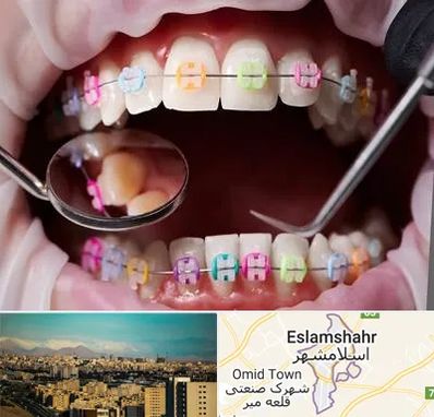 متخصص ارتودنسی در اسلامشهر