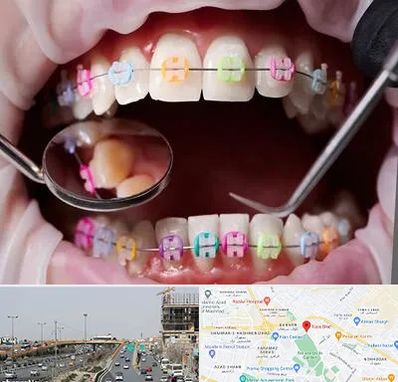 متخصص ارتودنسی در بلوار توس مشهد
