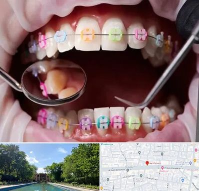 متخصص ارتودنسی در هشت بهشت اصفهان