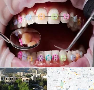 متخصص ارتودنسی در دیباجی