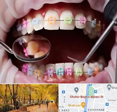 متخصص ارتودنسی در چهارباغ اصفهان