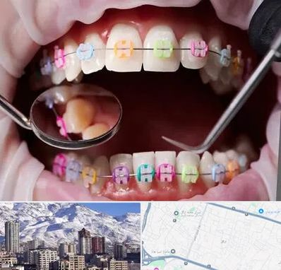 متخصص ارتودنسی در ازگل