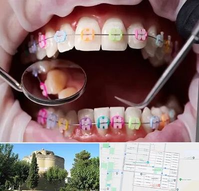 متخصص ارتودنسی در مرداویج اصفهان