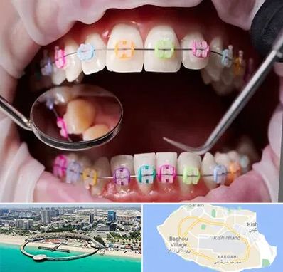 متخصص ارتودنسی در کیش