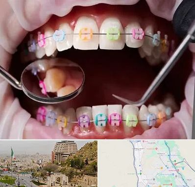 متخصص ارتودنسی در فرهنگ شهر شیراز