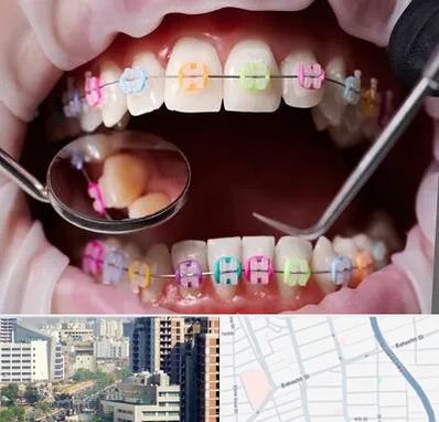 متخصص ارتودنسی در خیابان بهشتی