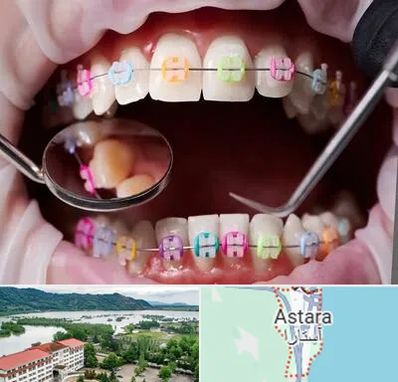 متخصص ارتودنسی در آستارا