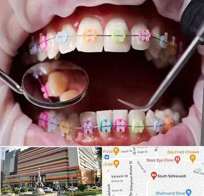 متخصص ارتودنسی در سهروردی 