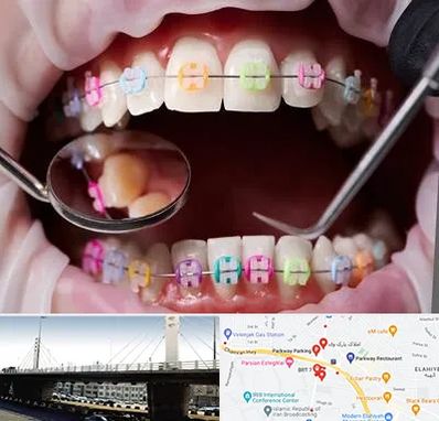 متخصص ارتودنسی در پارک وی 