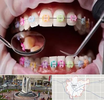 متخصص ارتودنسی در زابل