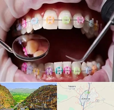 متخصص ارتودنسی در کامیاران