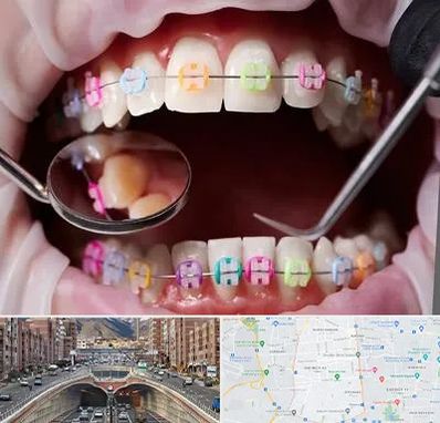 متخصص ارتودنسی در منطقه 10 تهران