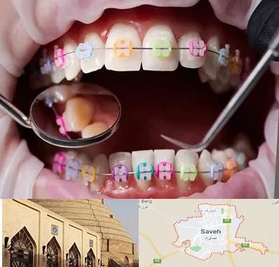 متخصص ارتودنسی در ساوه