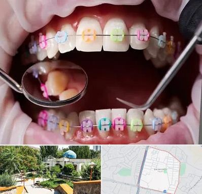 متخصص ارتودنسی در باغمیشه تبریز