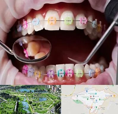 متخصص ارتودنسی در بجنورد