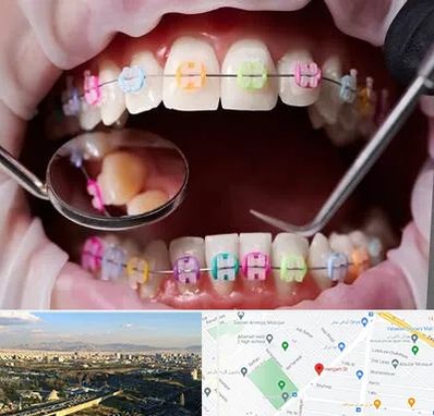 متخصص ارتودنسی در هنگام