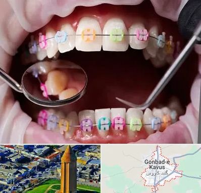 متخصص ارتودنسی در گنبد کاووس