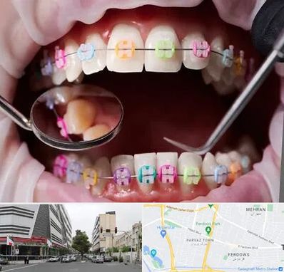 متخصص ارتودنسی در بلوار فردوس 
