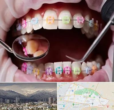 متخصص ارتودنسی در منطقه 4 تهران