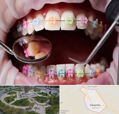متخصص ارتودنسی در ورامین