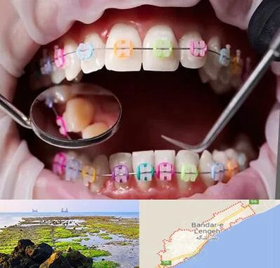 متخصص ارتودنسی در بندرلنگه