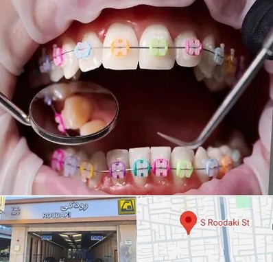 متخصص ارتودنسی در رودکی