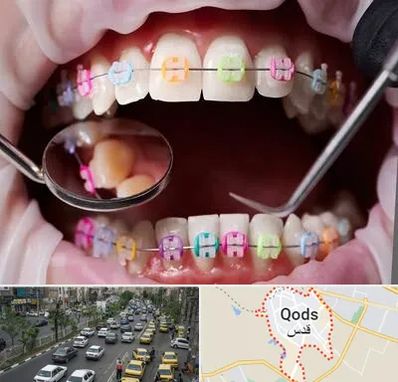 متخصص ارتودنسی در شهر قدس