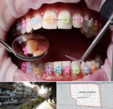 متخصص ارتودنسی در خیابان جمالزاده