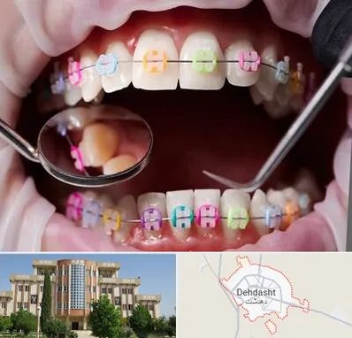 متخصص ارتودنسی در دهدشت