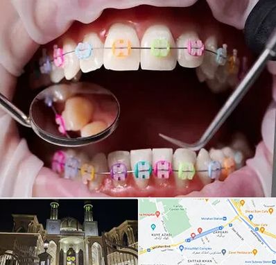 متخصص ارتودنسی در زرگری شیراز