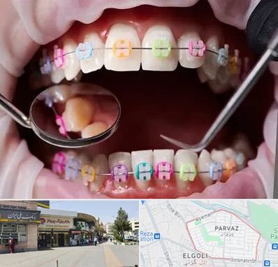 متخصص ارتودنسی در پرواز تبریز