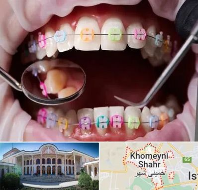 متخصص ارتودنسی در خمینی شهر