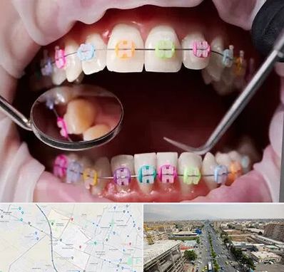 متخصص ارتودنسی در حصارک کرج