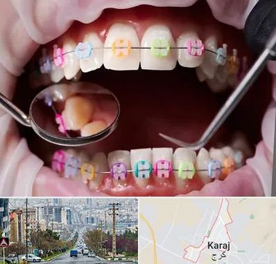 متخصص ارتودنسی در گوهردشت کرج 