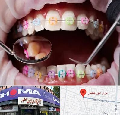 متخصص ارتودنسی در امین حضور