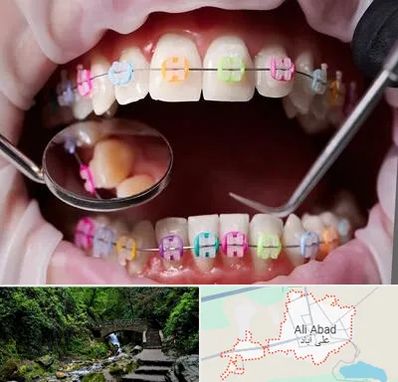 متخصص ارتودنسی در علی آباد کتول