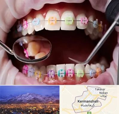 متخصص ارتودنسی در کرمانشاه