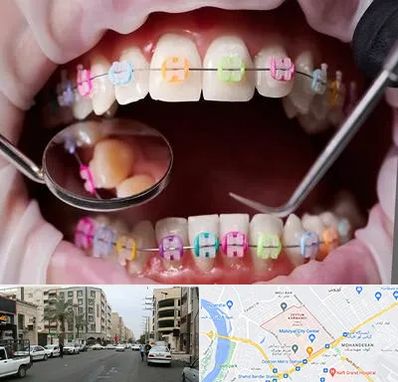 متخصص ارتودنسی در زیتون کارمندی اهواز