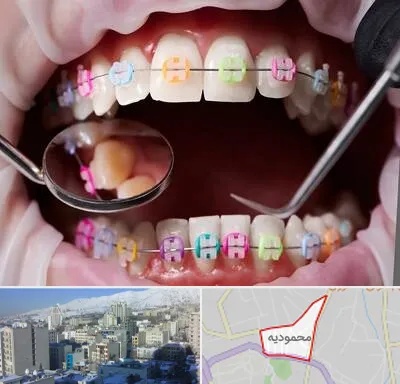 متخصص ارتودنسی در محمودیه