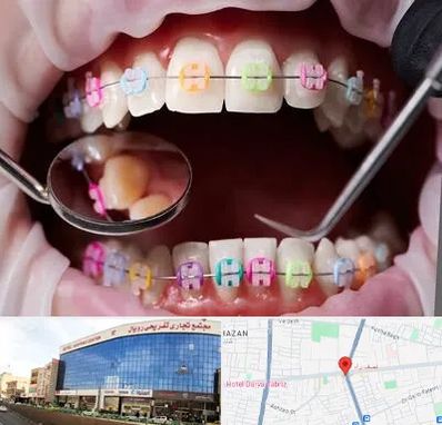 متخصص ارتودنسی در نصف راه تبریز