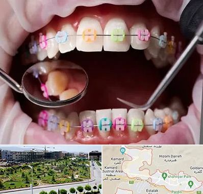 متخصص ارتودنسی در پردیس