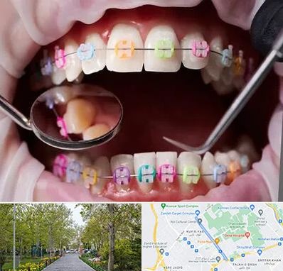 متخصص ارتودنسی در قدوسی غربی شیراز